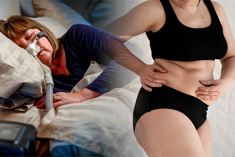 Menopause & Sleep Apnea: Visceral Fat is the Missing Link